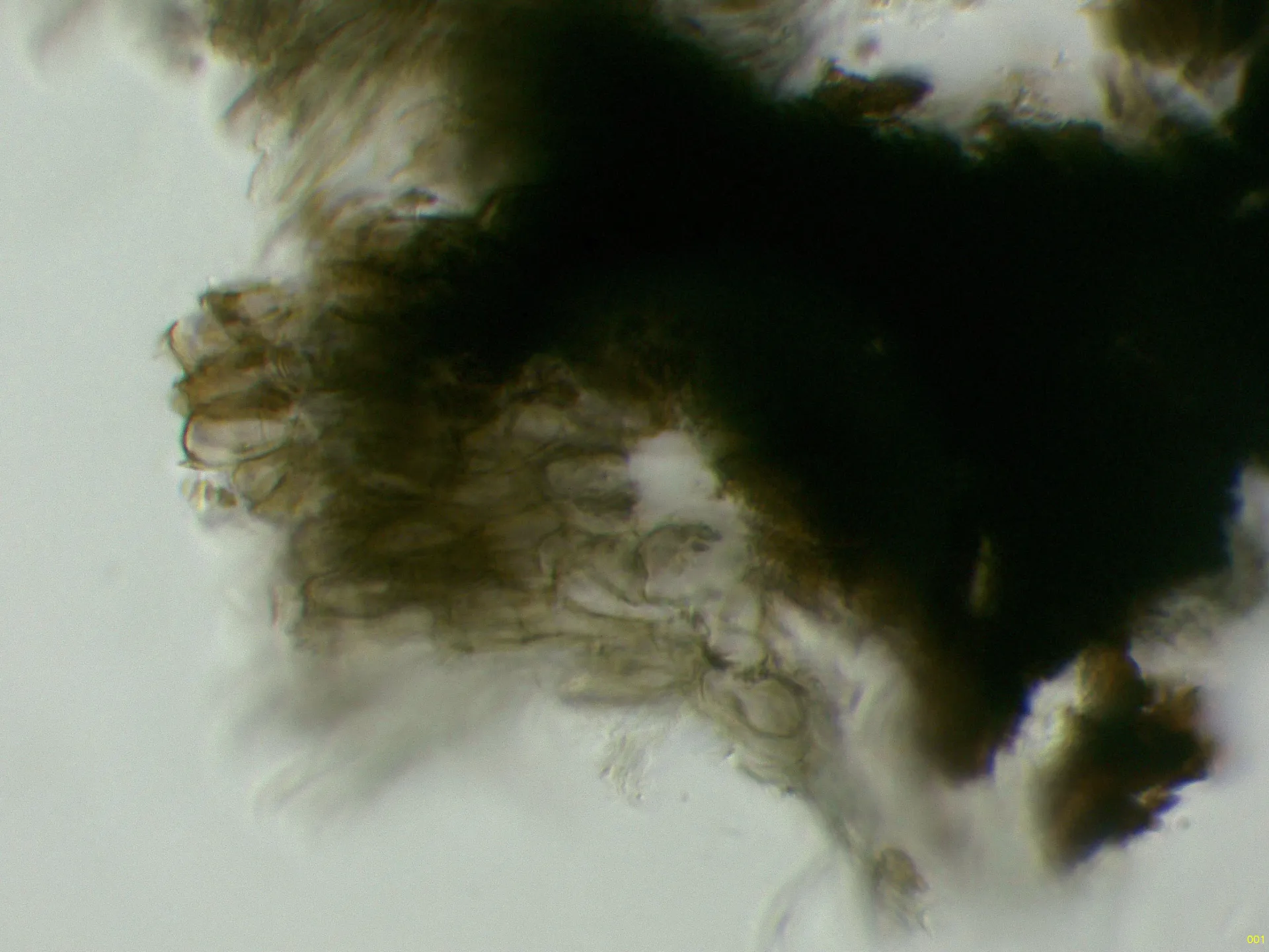 Microscopía de Rhytidhysteron neorufulum - 10 - Hifas peridio Melzer-001